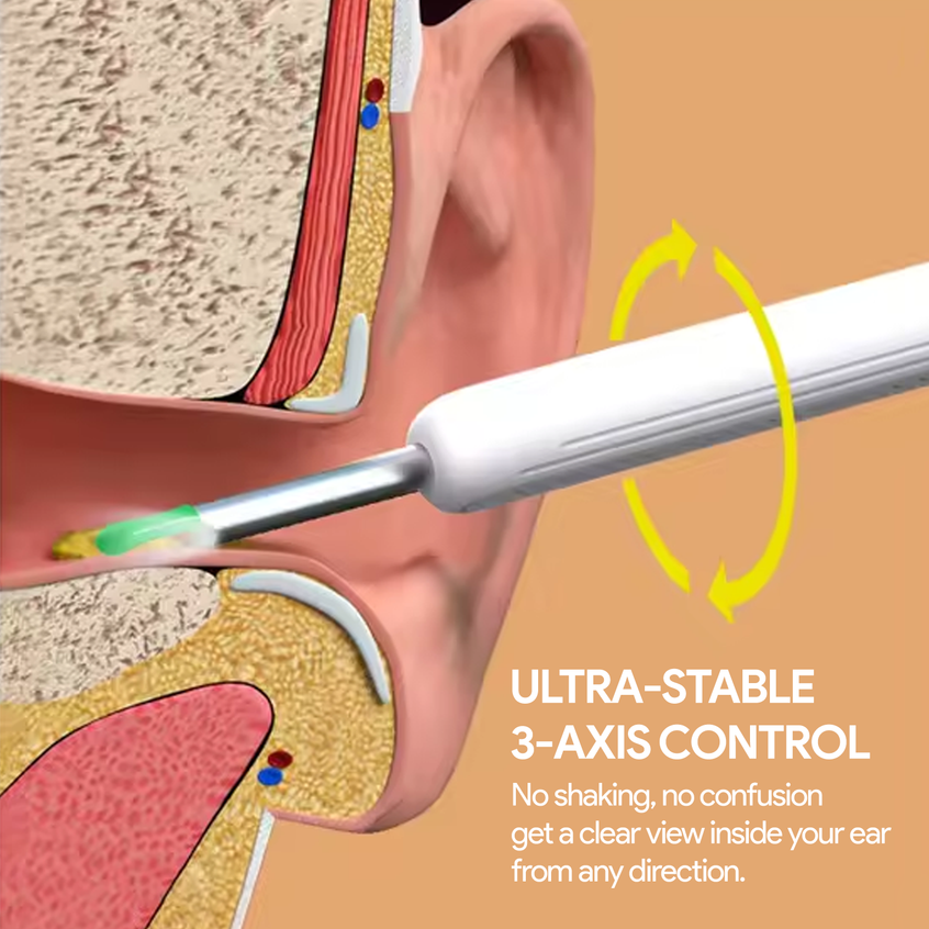 Illustration of an ear with a Nuwelo Clear Ear Wax Removal tool inside the ear showing ultra-stable 3-axis control feature.